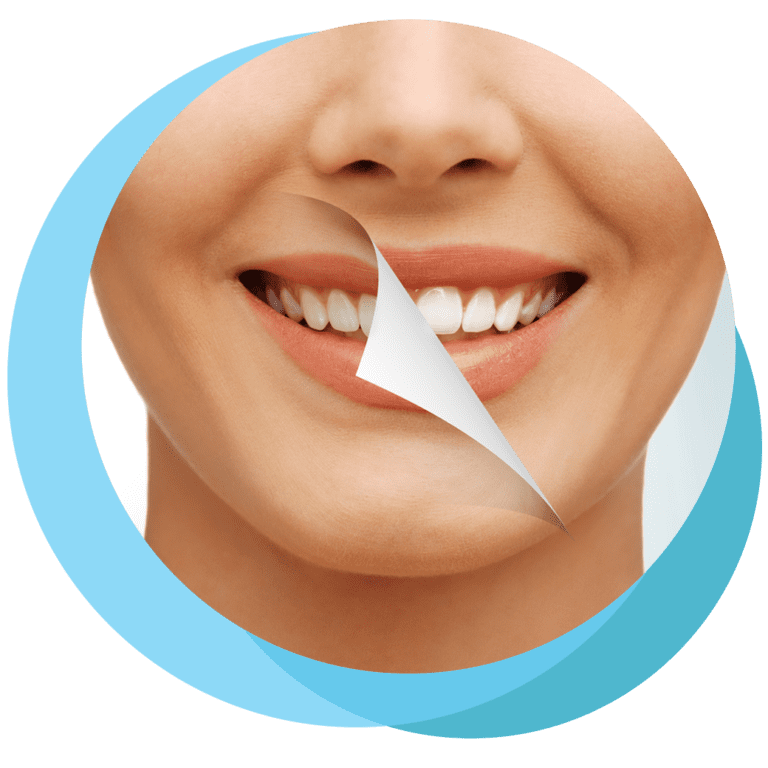 Aesthetic Dentistry