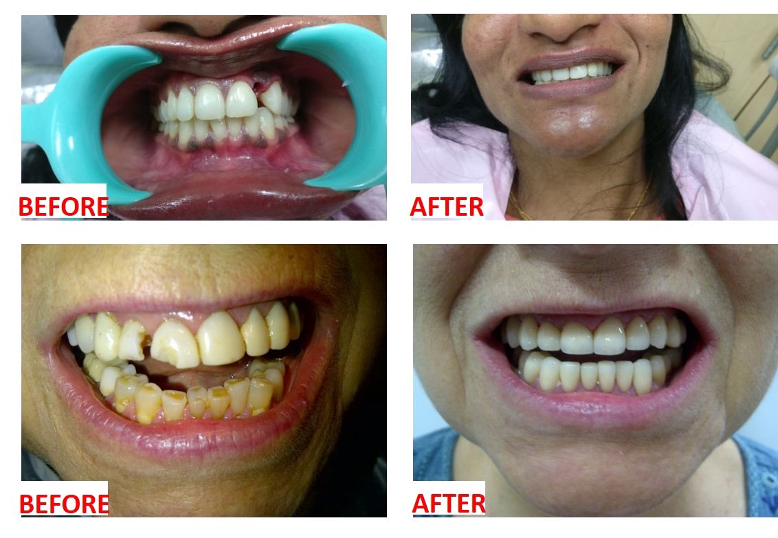 Aesthetic Dentistry