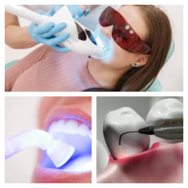 Laser Dentistry