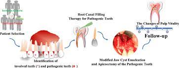 Procedure for Cysts and Tumours