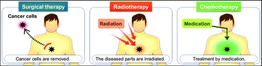 Cancer Surgery
