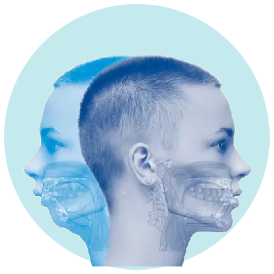 Orthognathic Surgery
